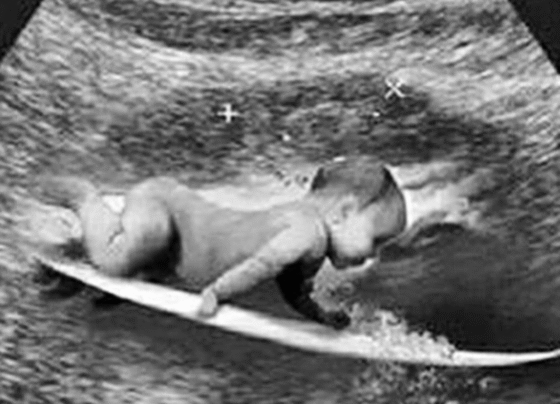 Reprodução: Instagram/@gabrielmedina