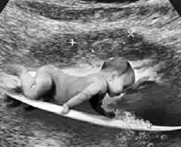 Reprodução: Instagram/@gabrielmedina